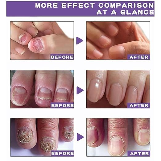 Nail Repair & Growth Serum Spray