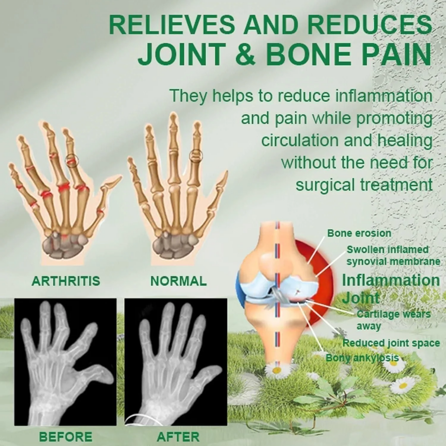 Bee Venom™ Joint and Bone Therapy Cream
