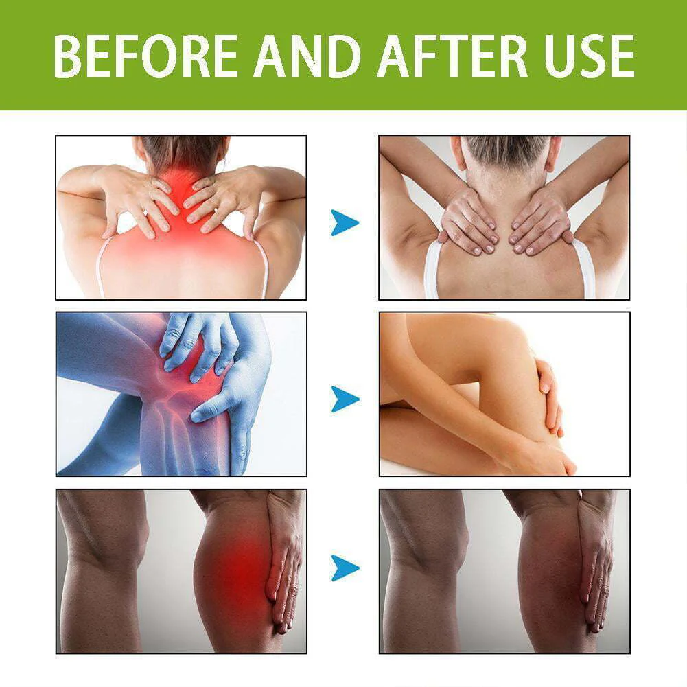 Bee Venom™ Joint and Bone Therapy Cream