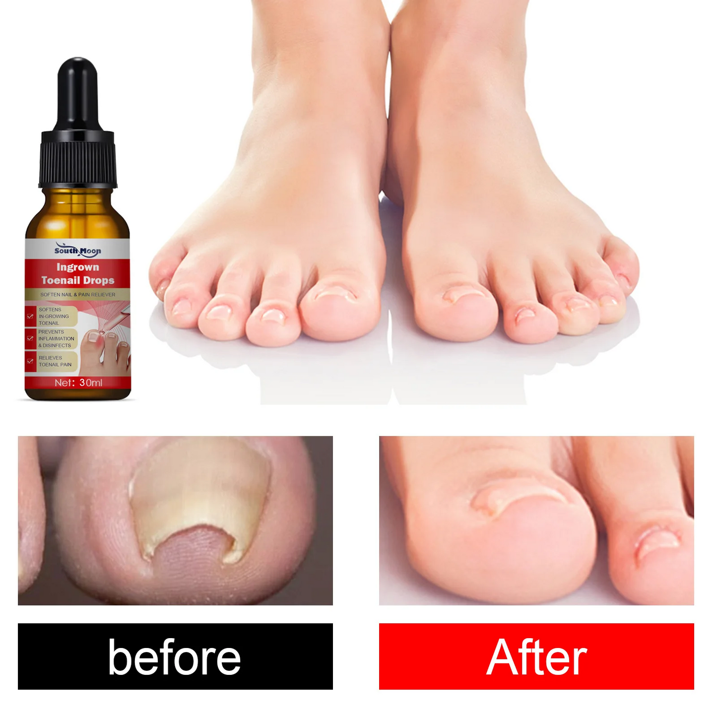 Toenail Drops Nail Repair Oil (BUY 1 GET 1 FREE๐ฅ๐ฅ)