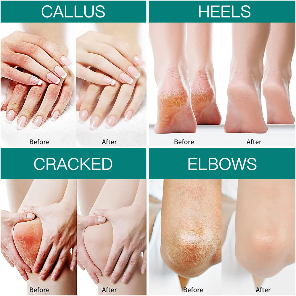 JENSY Alll in One Hand and Feet Cream - Deep Hydration and Crack Repair