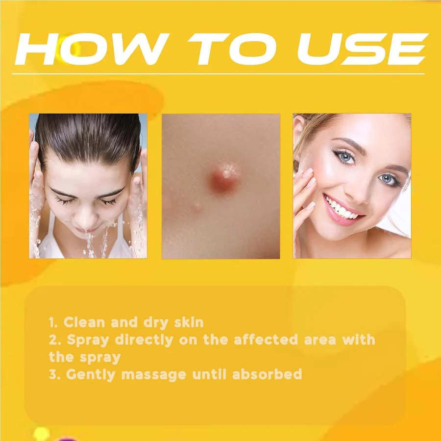 Bee Venom Skin Tag & Wart Remover Spray
