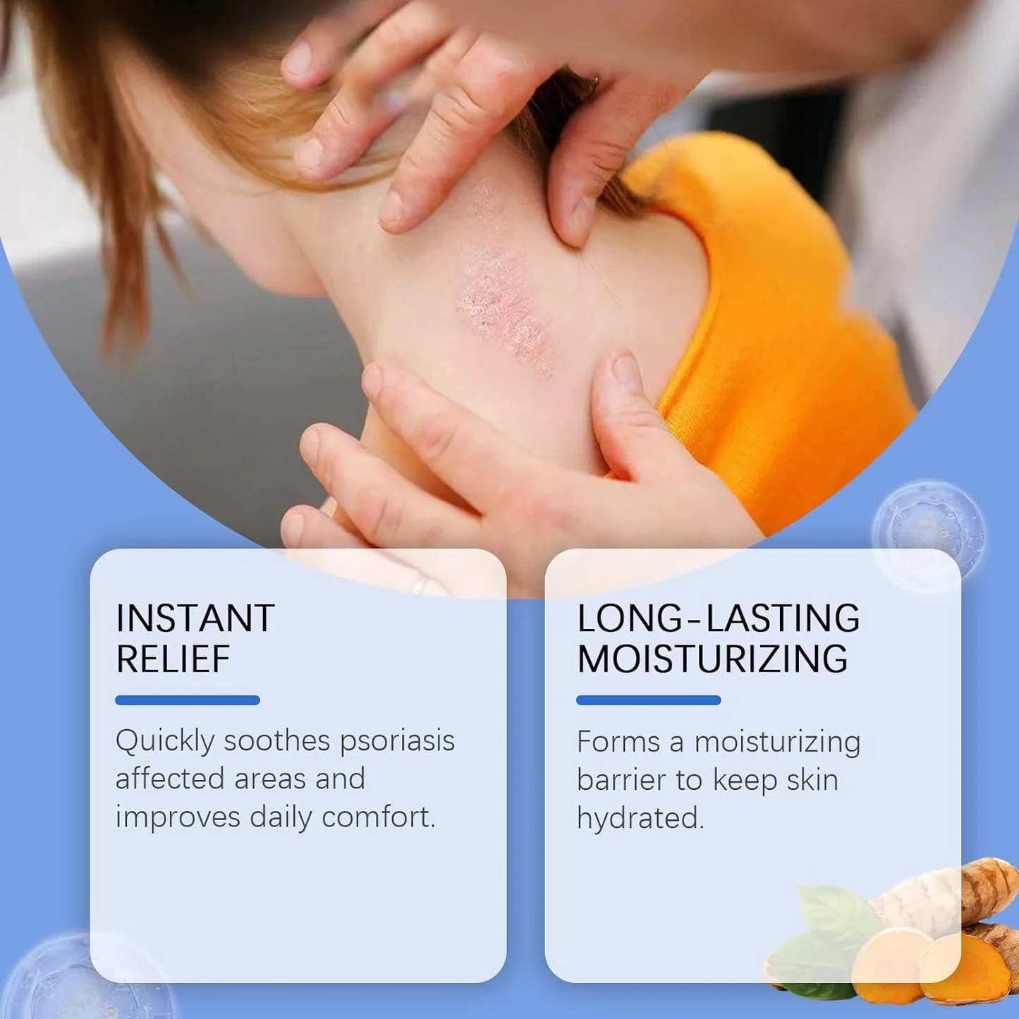 BeeVenom Psoriasis Treatment Spray
