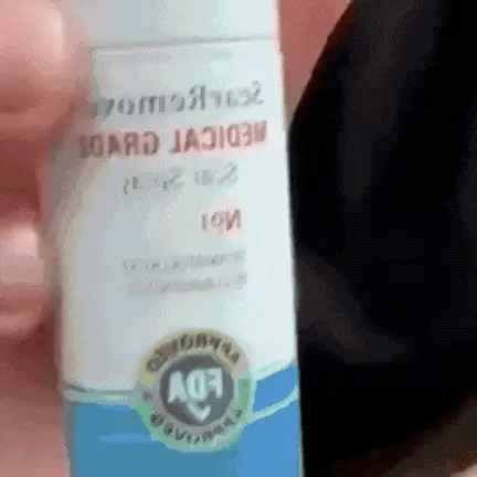 QB Scar Removal Spray - Say Goodbye to Scars Forever 🌟🌿