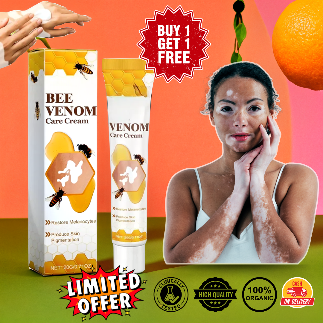 VitiGO Correcting Cream - (✅Buy 1 Get 1 FREE- 30 Days Pack)