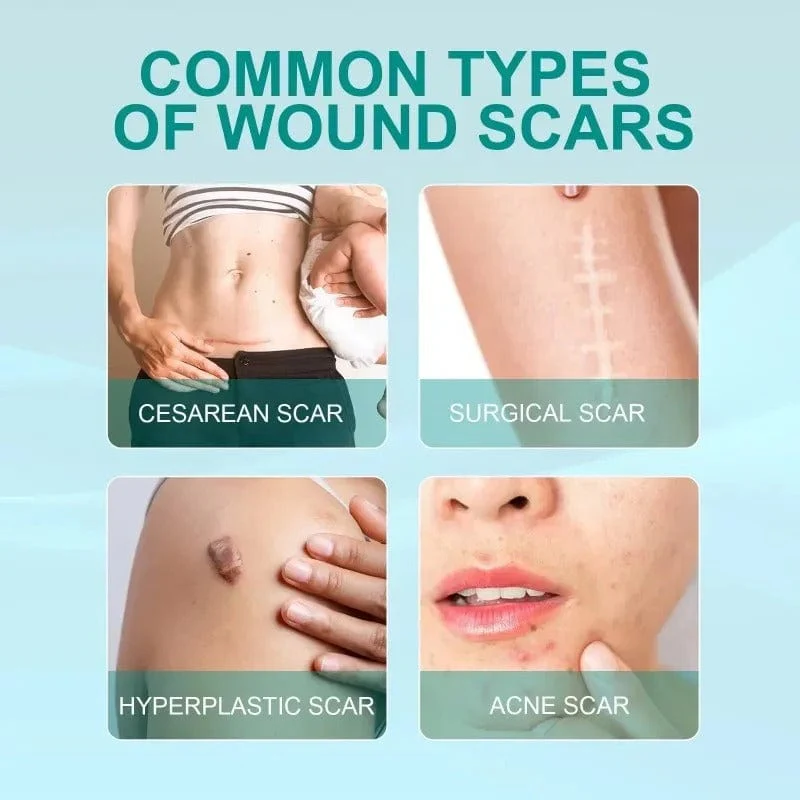 QB Scar Removal Spray - Say Goodbye to Scars Forever 🌟🌿
