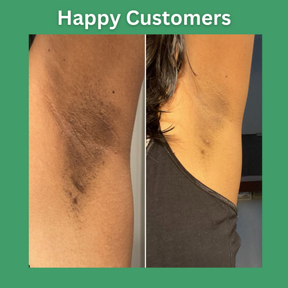 QB™ Under Arm Whitening Spray