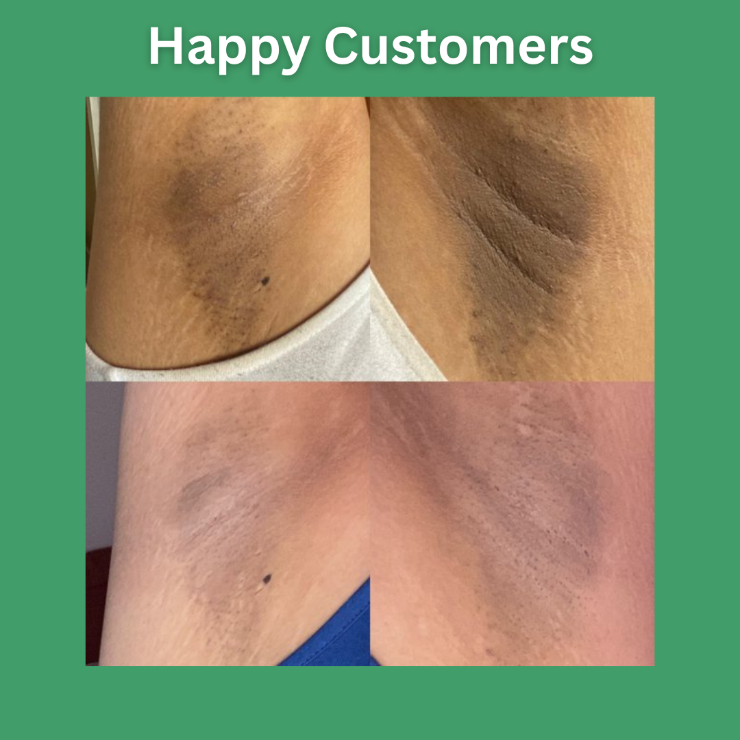 QB™ Under Arm Whitening Spray