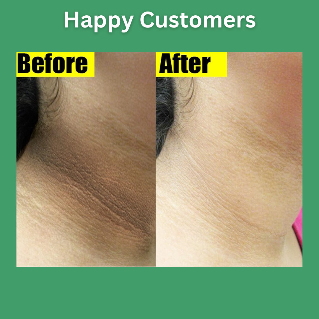 QB™ Under Arm Whitening Spray