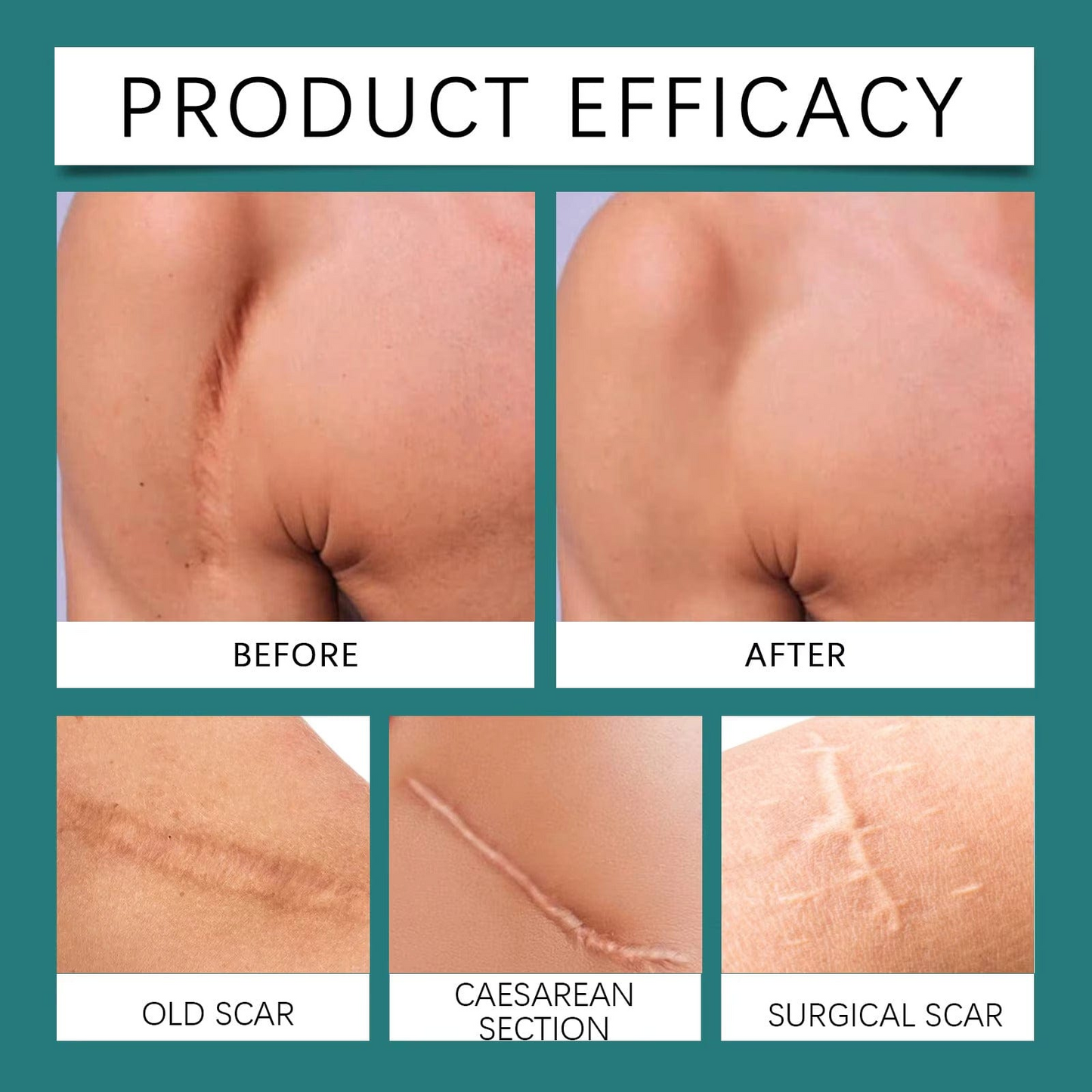 QB Scar Removal Spray - Say Goodbye to Scars Forever 🌟🌿