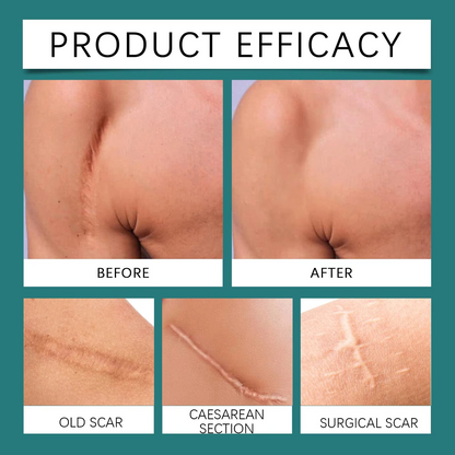 QB Scar Removal Spray - Say Goodbye to Scars Forever 🌟🌿