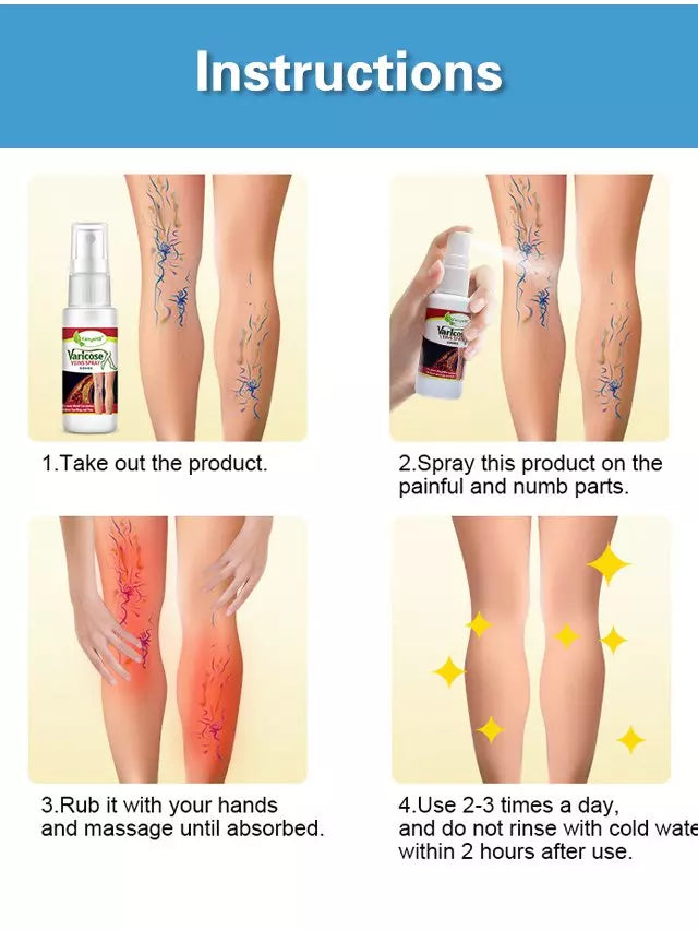Varicose Veins Treatment Spray 🌿100% Herbal🌿