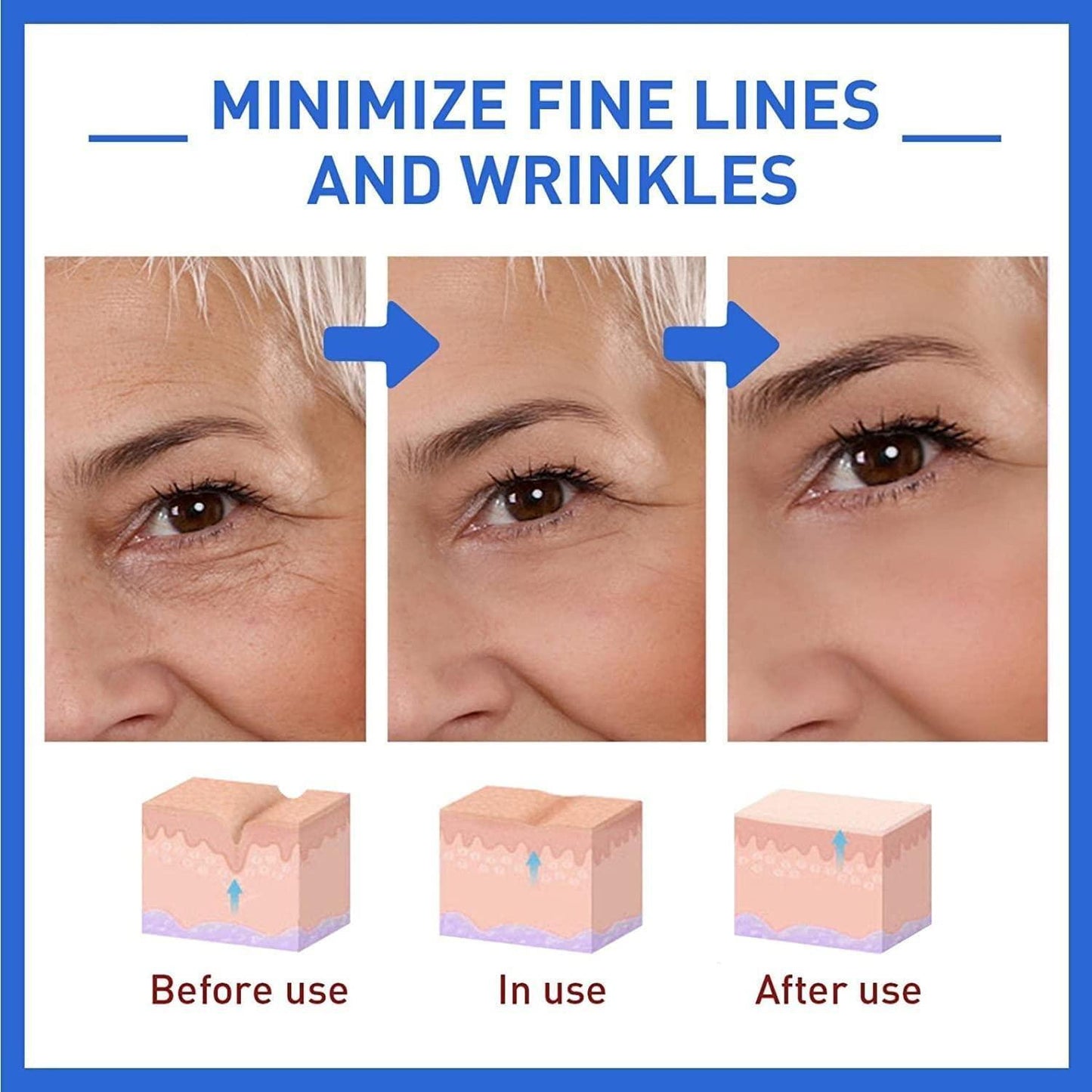 Botox Skin Tightening & Anti-Aging Serum