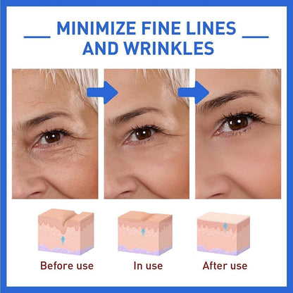 Botox Skin Tightening & Anti-Aging Serum