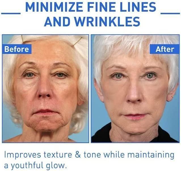 Botox Skin Tightening & Anti-Aging Serum