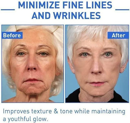 Botox Skin Tightening & Anti-Aging Serum