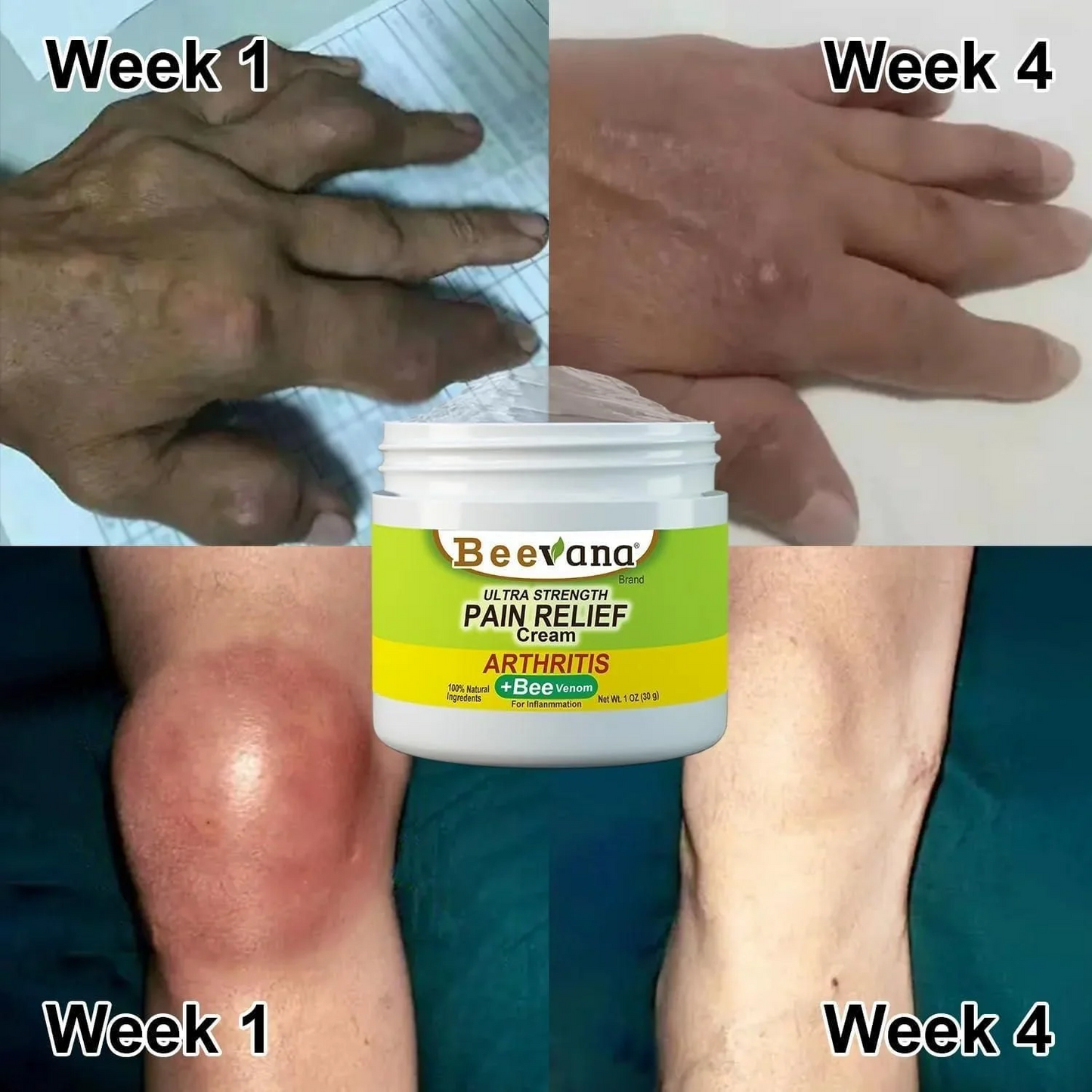 Bee Venom Pain Relief Cream (50gm) - Buy 1 Get 1 FREE