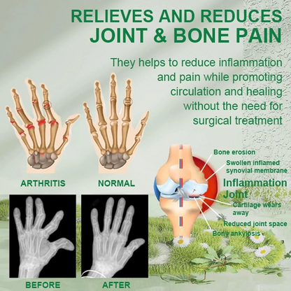 Bee Venom Pain Relief Cream (50gm) - Buy 1 Get 1 FREE