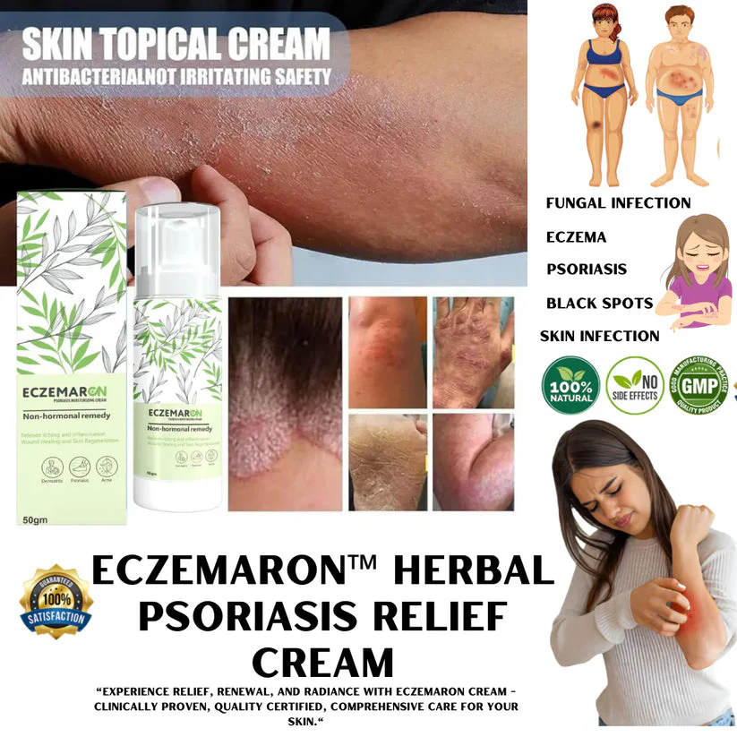 Eczemaron Anti-Fungal Spray - Instant Relief from Itching & Infection (Buy 1 Get 1 FREE🔥🔥)