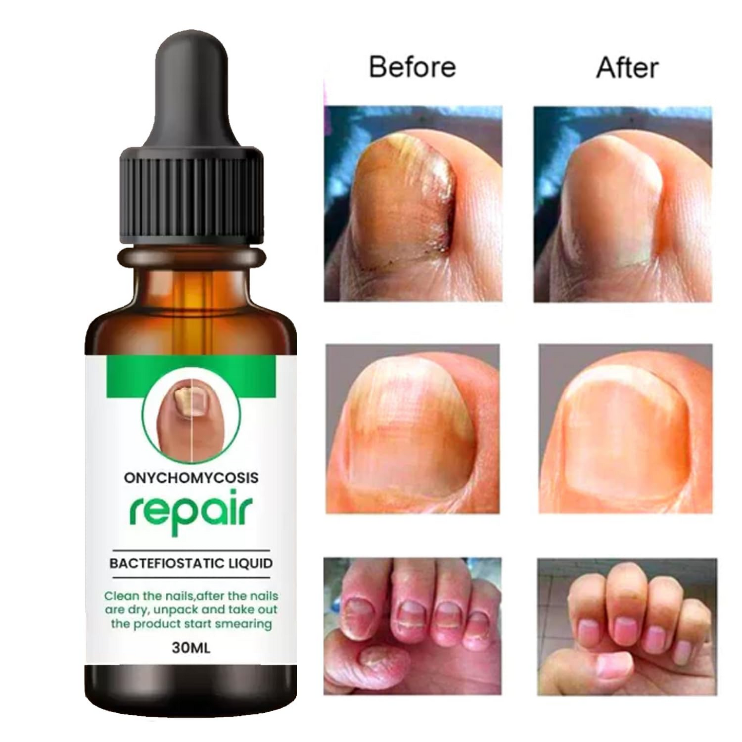 Nail Repair & Growth Herbal Serum Spray - (Buy 1 Get 1 FREE🔥🔥)