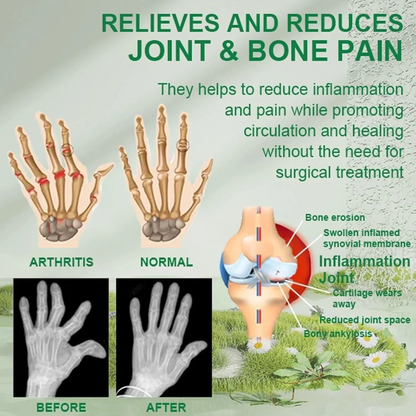 Bee Venom™ Joint and Bone Therapy Cream