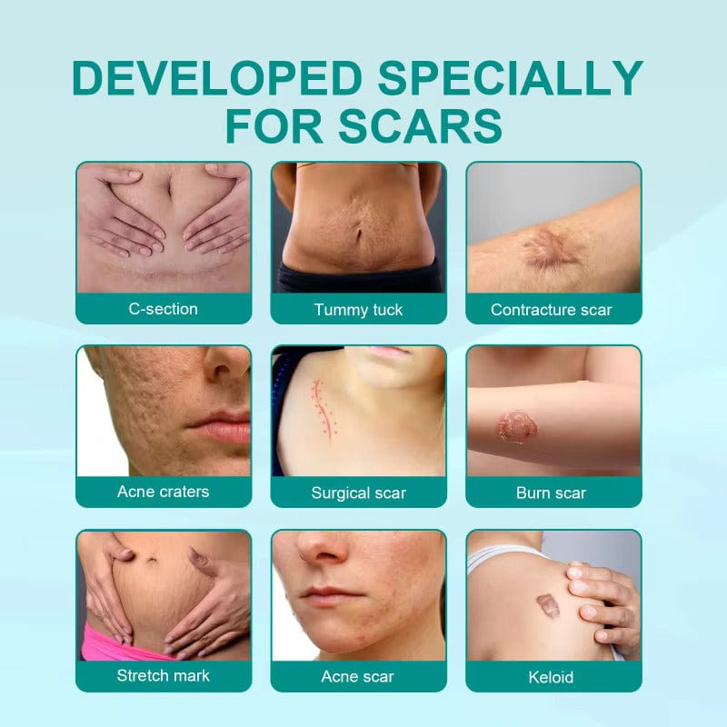 QB Scar Removal Spray - Say Goodbye to Scars Forever 🌟🌿