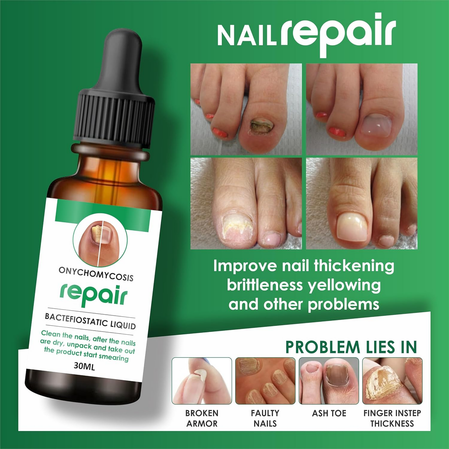 Nail Repair & Growth Herbal Serum Spray - (Buy 1 Get 1 FREE🔥🔥)