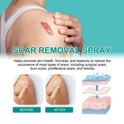 QB Scar Removal Spray - Say Goodbye to Scars Forever 🌟🌿