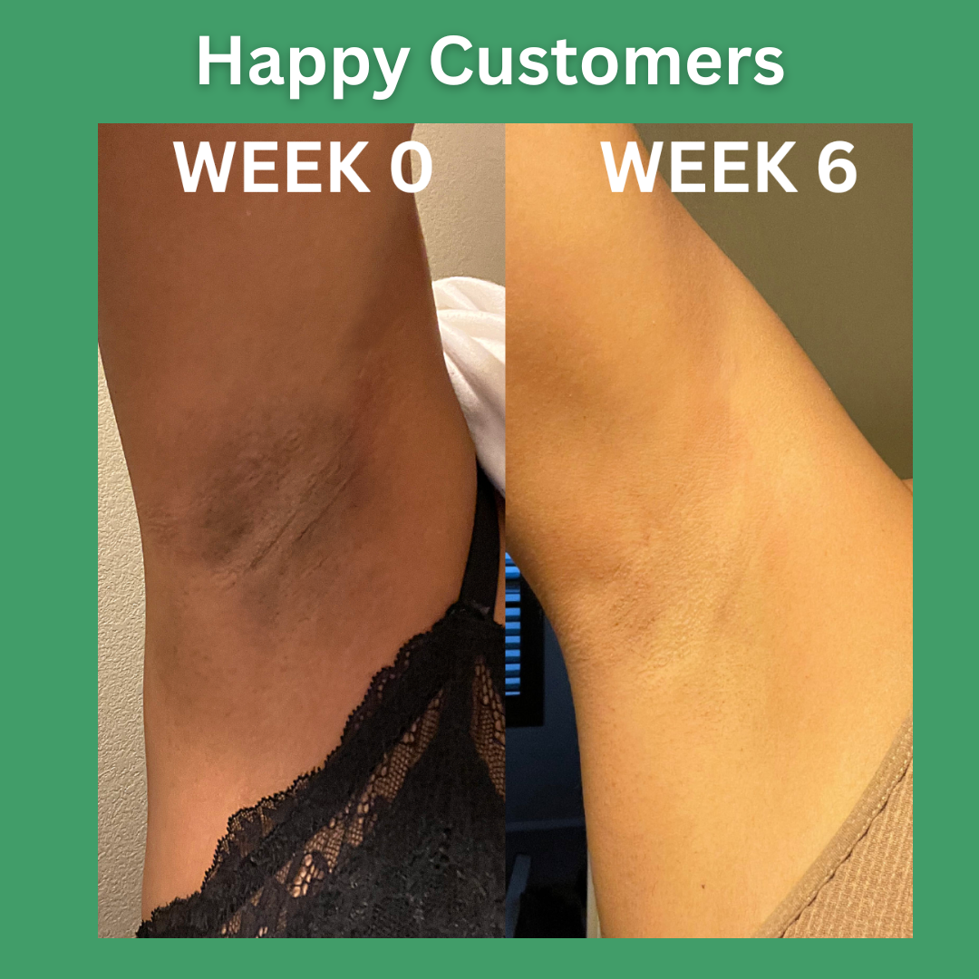 QB™ Under Arm Whitening Spray