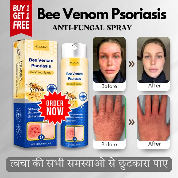 LOVILDS™ Anti Fungal Spray - BUY 1 GET 1 FREE