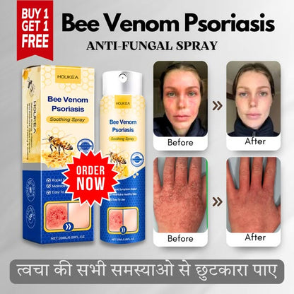 LOVILDS™ Anti Fungal Spray - BUY 1 GET 1 FREE