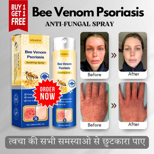 LOVILDS™ Anti Fungal Spray - BUY 1 GET 1 FREE