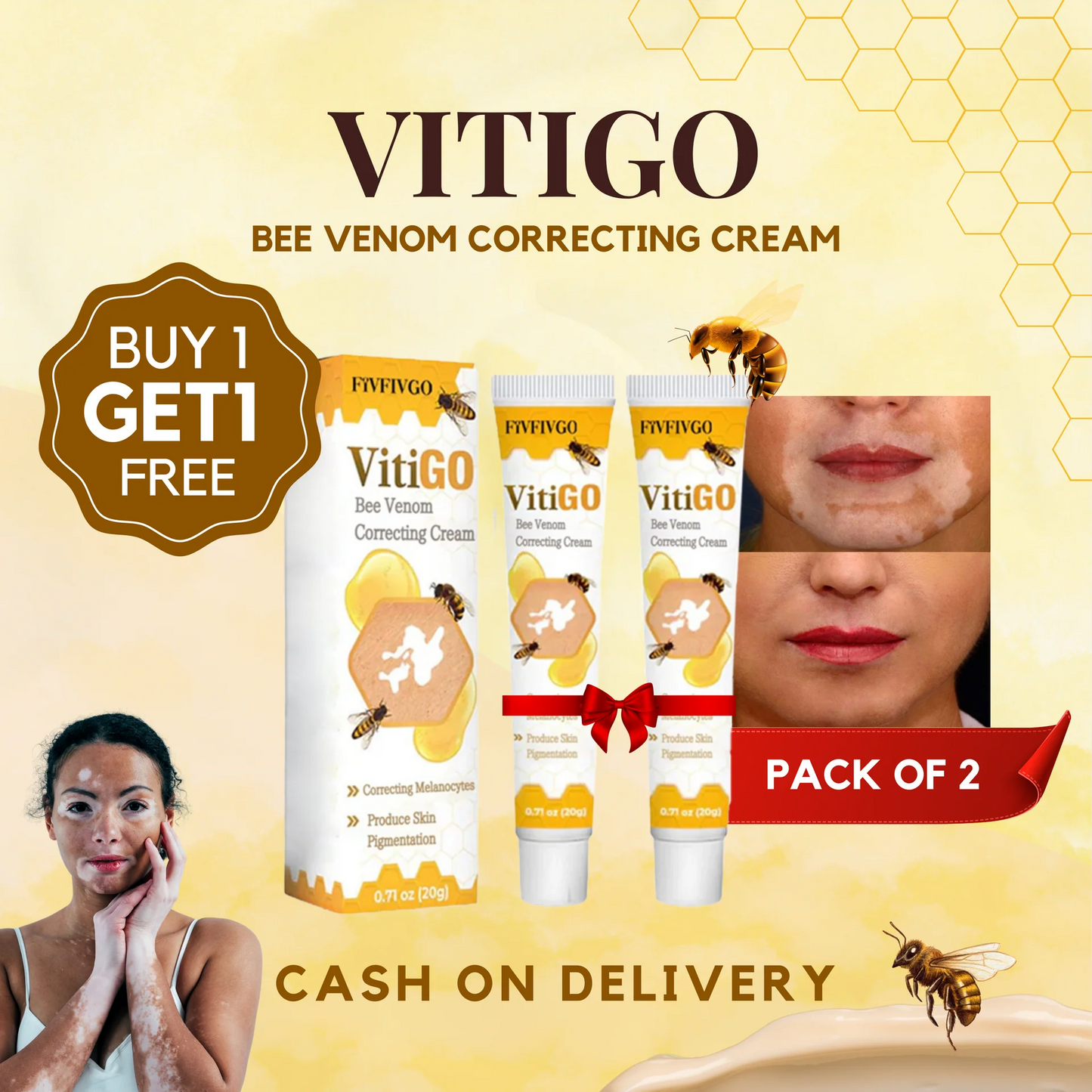 VitiGO Correcting Cream - (✅Buy 1 Get 1 FREE- 30 Days Pack)