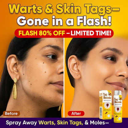 Bee Venom Wart Remover Spray