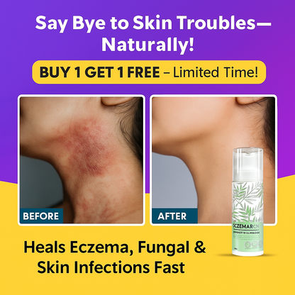 Eczemaron Anti-Fungal Spray - Instant Relief from Itching & Infection (Buy 1 Get 1 FREE🔥🔥)