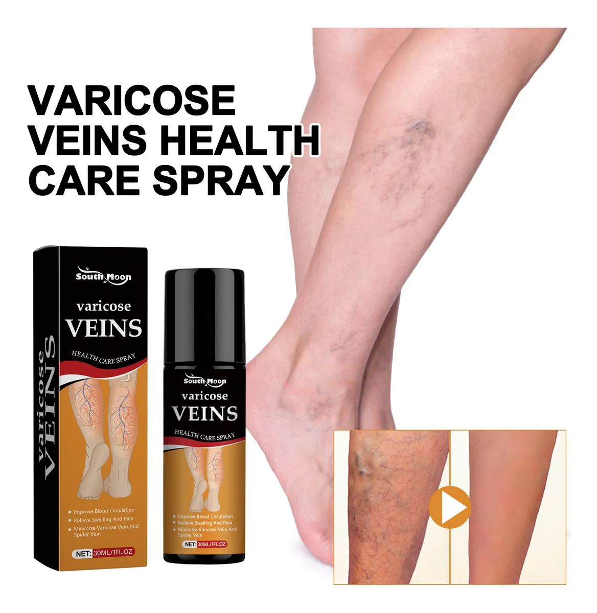 Varicose Veins Relief Spray - (BUY 1 GET 1 FREE🔥🔥)