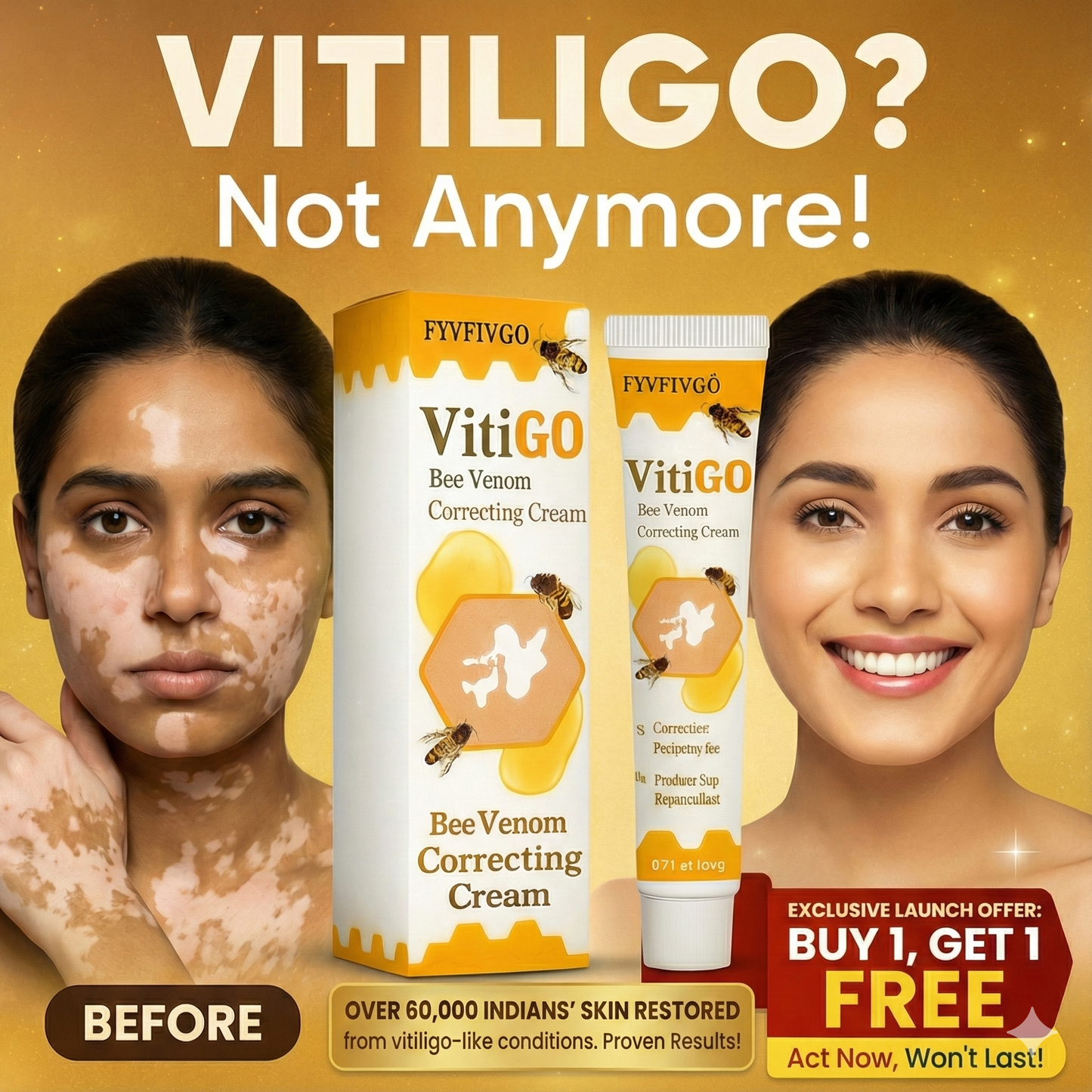 VitiGO Correcting Cream - (✅Buy 1 Get 1 FREE- 30 Days Pack)
