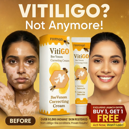 VitiGO Correcting Cream - (✅Buy 1 Get 1 FREE- 30 Days Pack)