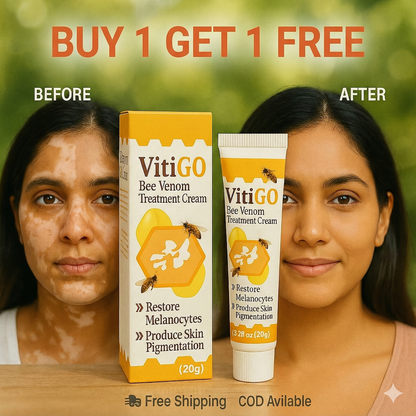 VitiGO Correcting Cream - (✅Buy 1 Get 1 FREE- 30 Days Pack)