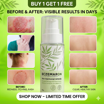Eczemaron Herbal Anti-Fungal Spray 🌿 | Buy 1 Get 1 FREE 🔥