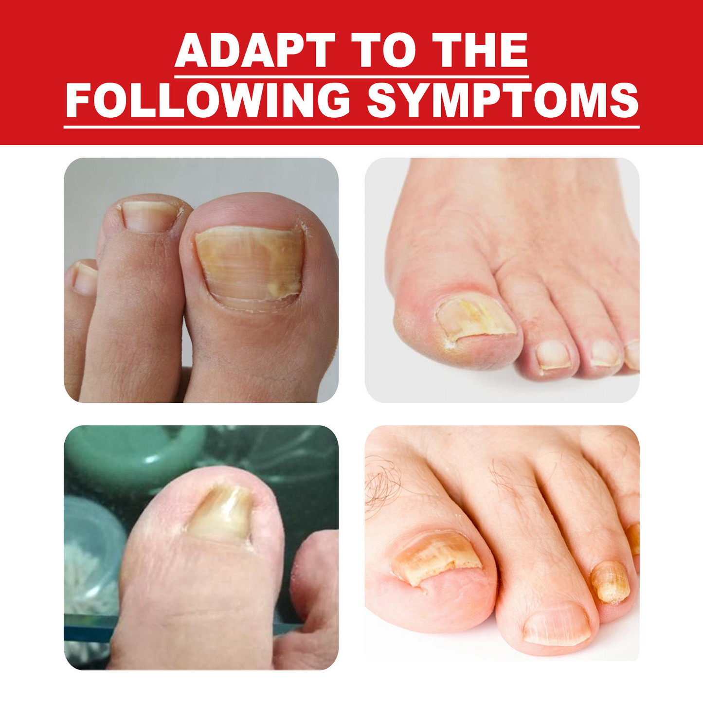 Toenail Drops Nail Repair Oil (BUY 1 GET 1 FREE🔥🔥)
