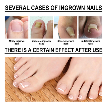 Toenail Drops Nail Repair Oil (BUY 1 GET 1 FREE🔥🔥)
