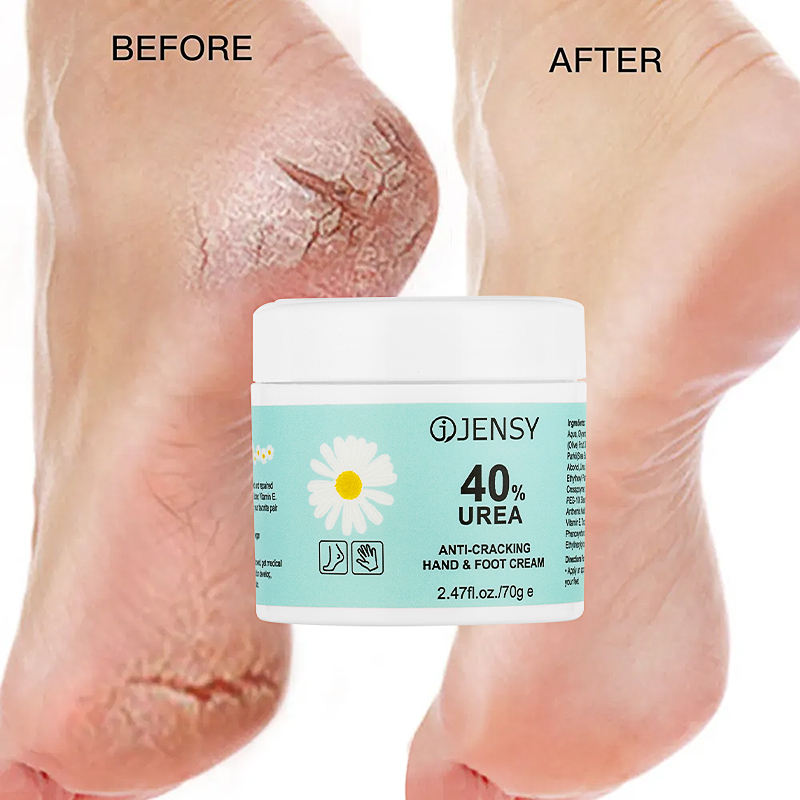 JENSY Alll in One Hand and Feet Cream - Deep Hydration and Crack Repair