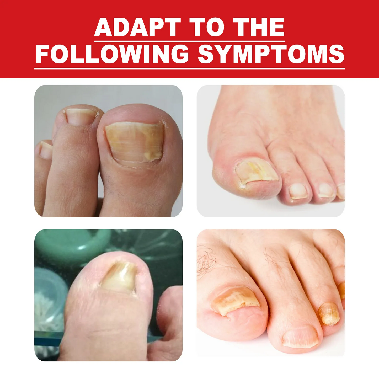 Toenail Drops Nail Repair Oil (BUY 1 GET 1 FREE🔥🔥)