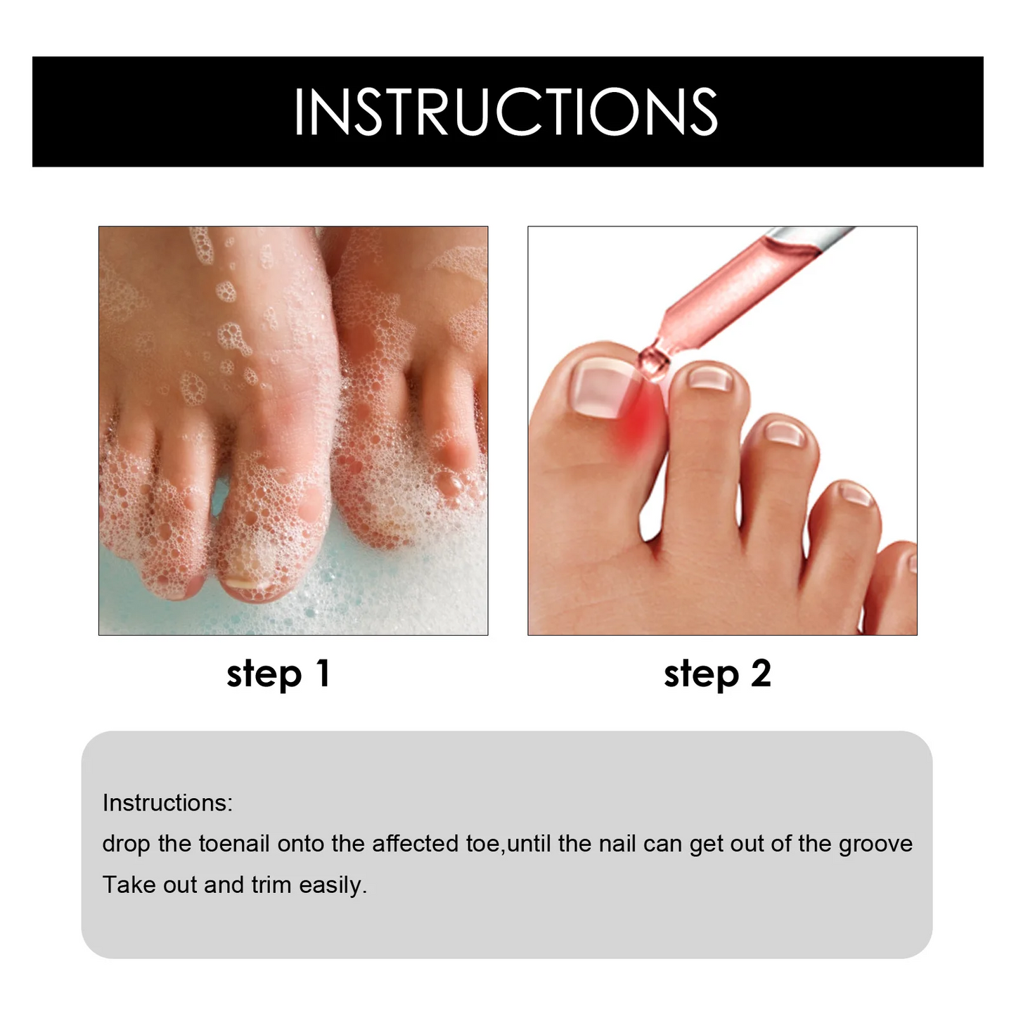 Toenail Drops Nail Repair Oil (BUY 1 GET 1 FREE🔥🔥)