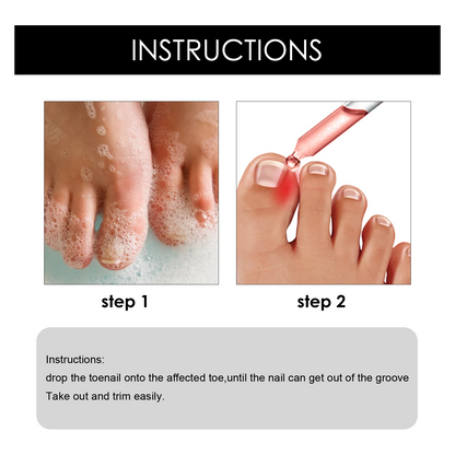 Toenail Drops Nail Repair Oil (BUY 1 GET 1 FREE🔥🔥)