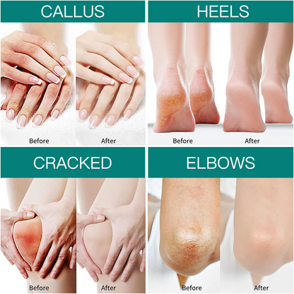 JENSY Alll in One Hand and Feet Cream - Deep Hydration and Crack Repair
