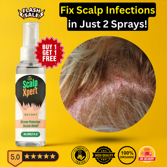 QB ScalpXpert Herbal Anti Fungal Spray - Buy 1 Get 1 FREE