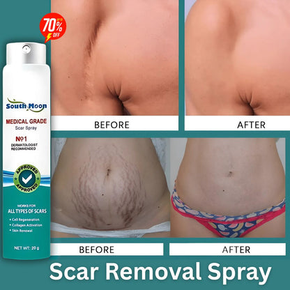 QB Scar Removal Spray - Say Goodbye to Scars Forever 🌟🌿