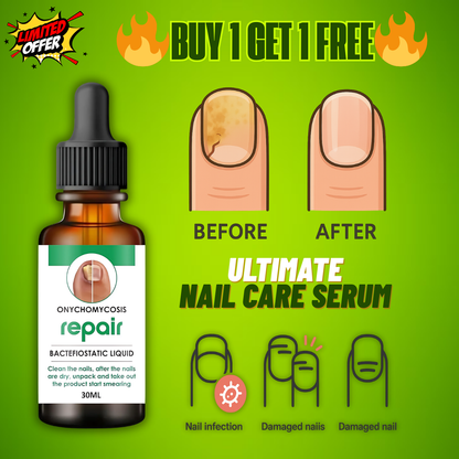 Nail Repair & Growth Herbal Serum Spray - (Buy 1 Get 1 FREE🔥🔥)